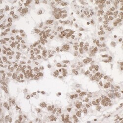 RPA2, p Ser4, p Ser8 Antibody, Novus Biologicals 0.1mL; Unlabeled:Antibodies,